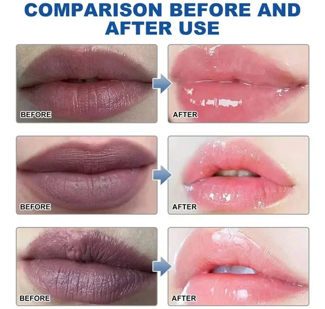 Remove Dark Lip Balm Fast Lightening Pink Lip Exfoliating Fade Lip Line Dead Skin Moisturizer Korean Care Products Beauty Health
