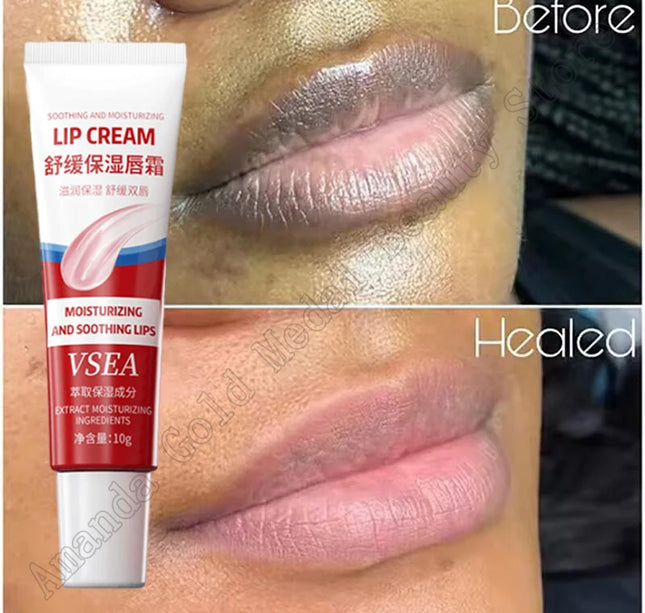 Remove Dark Lip Balm Fast Lightening Pink Lip Exfoliating Fade Lip Line Dead Skin Moisturizer Korean Care Products Beauty Health