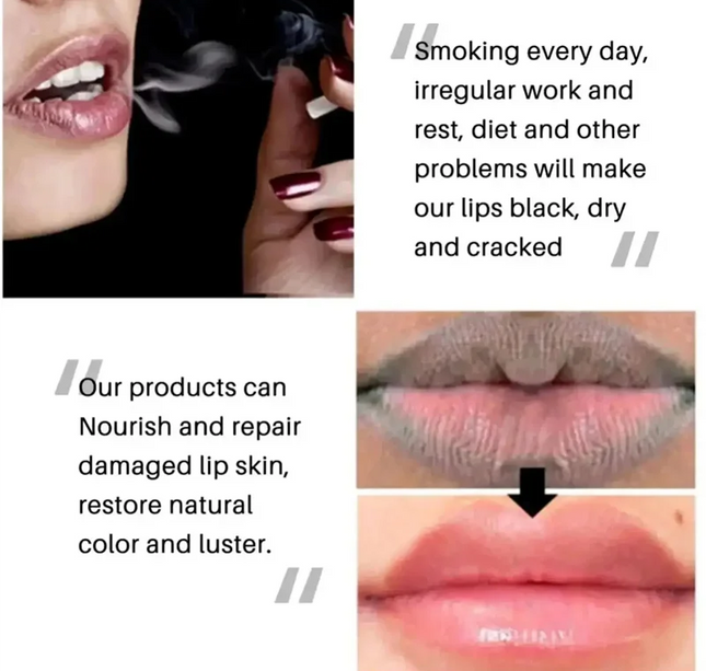 Remove Dark Lip Balm Fast Lightening Pink Lip Exfoliating Fade Lip Line Dead Skin Moisturizer Korean Care Products Beauty Health