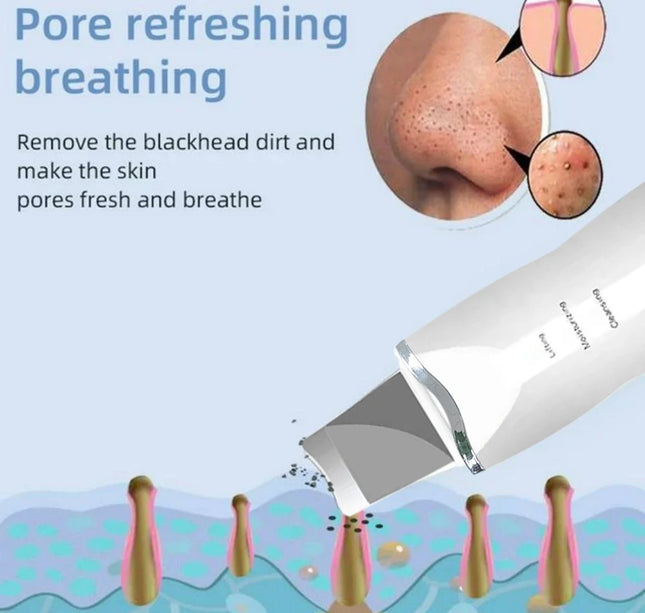 Ultrasonic Skin Scraper Pore Cleaning Facial Deep Cleaning Machine Suitable for Female and Male Beauty Instruments