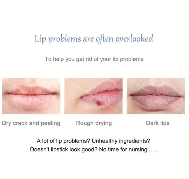 Remove Dark Lip Balm Fast Lightening Pink Lip Exfoliating Fade Lip Line Dead Skin Moisturizer Korean Care Products Beauty Health