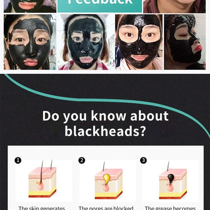 LANBENA Remove Blackhead Mask Shrinking Pore Deep Cleaning Mask Improve Rough Skin Acne Treatment Skin Brighteing Care Beauty