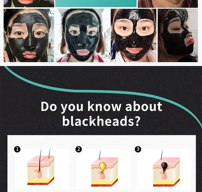 LANBENA Remove Blackhead Mask Shrinking Pore Deep Cleaning Mask Improve Rough Skin Acne Treatment Skin Brighteing Care Beauty