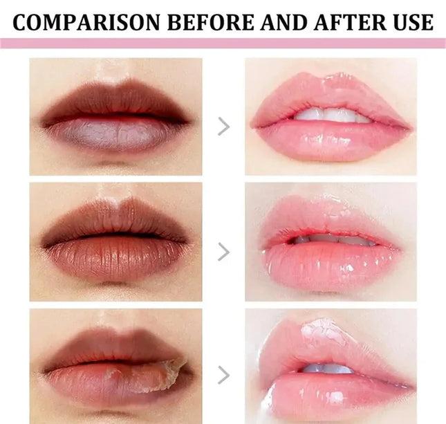 Remove Dark Lip Balm Fast Lightening Pink Lip Exfoliating Fade Lip Line Dead Skin Moisturizer Korean Care Products Beauty Health