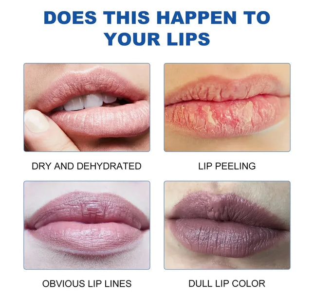 Remove Dark Lip Balm Fast Lightening Pink Lip Exfoliating Fade Lip Line Dead Skin Moisturizer Korean Care Products Beauty Health